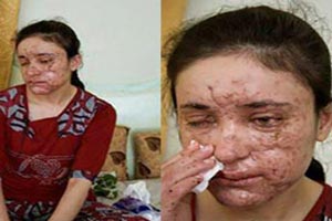 همخوابی وحشتناک با دختر 18 ساله + عکس