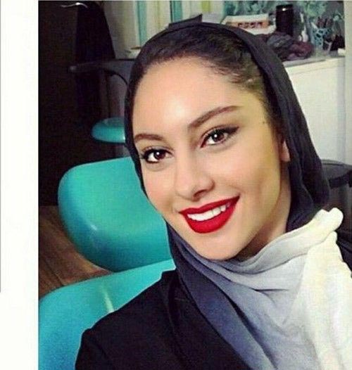 استوری جراحی چشم گربه ای ترلان پروانه جنجالی شد + تصاویر