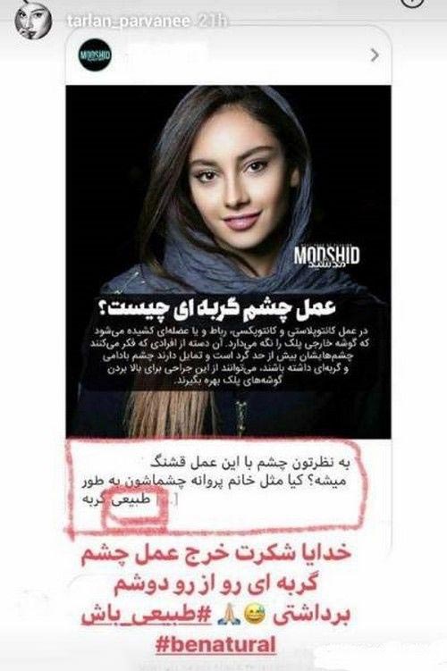 استوری جراحی چشم گربه ای ترلان پروانه جنجالی شد + تصاویر