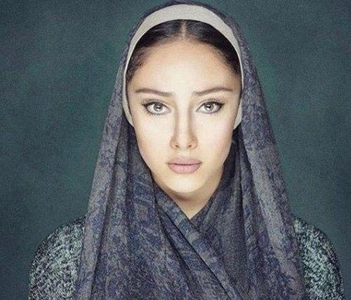 استوری جراحی چشم گربه ای ترلان پروانه جنجالی شد + تصاویر