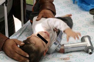 چرخ شدن دست پسر اصفهانی در چرخ گوشت 18+ عکس