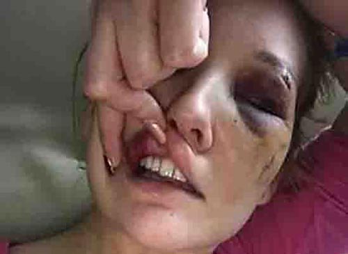 تصاویر سلفی های هولناک پس از تجاوز جنسی به دختر جوان