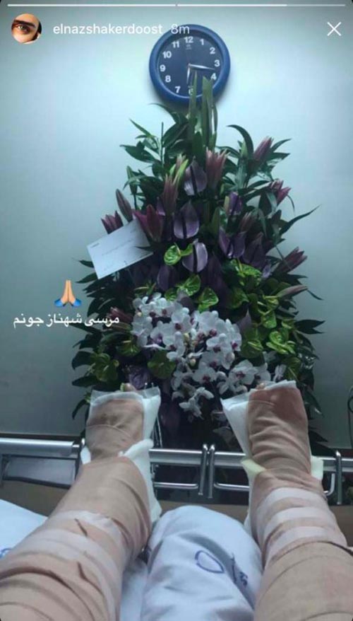 عکس پاهای شکسته الناز شاکردوست / اینستا پست متفاوت