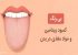 تشخیص بیماری با رنگ زبان + تصاویر
