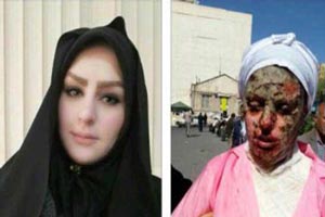 فیلم اسیدپاشی به دختر تبریزی