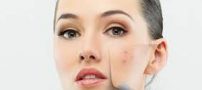 نشانه های عجیب لک های پوستی که باید حتما به پزشک بروید