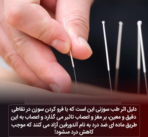 عکس نوشته های دانستنی؛ از باد شکم تا لاک 3 بعدی لاک پشت!