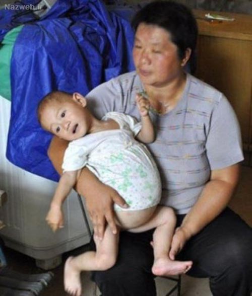 حاملگی 9 ماهه دختر یکساله سرراهی داغ ترین خبر دنیا + تصاویر
