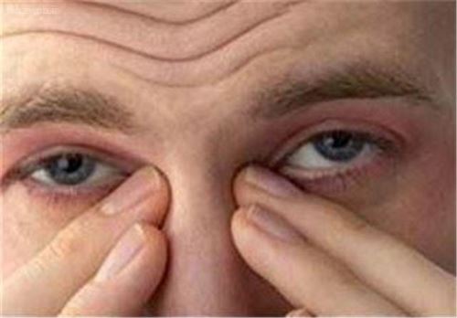 علت درد پیشانی و پشت چشم ها/ علت سردردهای عصرگاهی و صبحگاهی