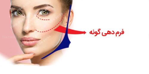 تزریق بوتاکس به طور دائم چه عوارضی دارد/ سم بوتولینوم