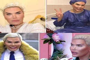پسر عروسکی و باربی برای 7 عمل زیبایی به ایران آمد + تصاویر پسر عروسکی و باربی برای 7 عمل زیبایی به ایران آمد + تصاویر