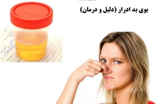 رنگ ادرار و بوی آن نشانه چه بیماری هایی است