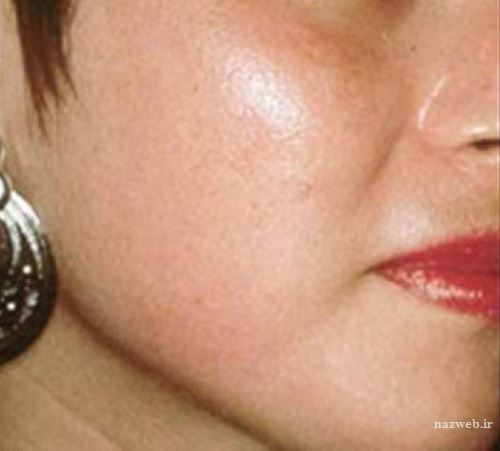 ماسک جوان کننده به پیشنهاد پریانکا چوبرا زیباترین بازیگر