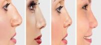 مخاط بینی چیست و رنگ های بینی نشانه ی چه بیماری است