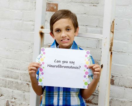 بیماری کارناوان چیست و چه علائمی دارد + عکس