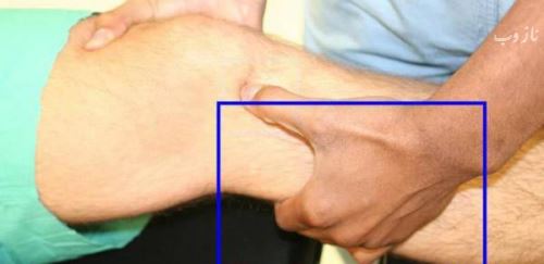 سرطان استخوان چیست و چه نشانه هایی دارد