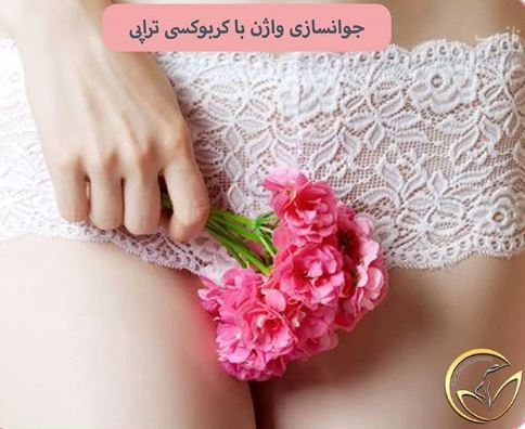 روش های جوان سازی و زیبایی واژن خانم ها 18+