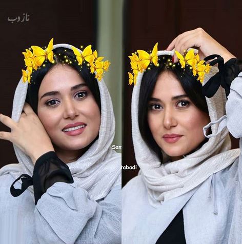 جراحی های پریناز ایزدیار و اقدام خبر ساز وی+ تصاویر