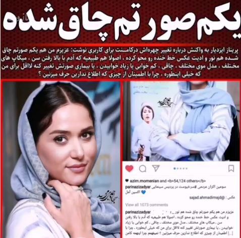 جراحی های پریناز ایزدیار و اقدام خبر ساز وی+ تصاویر