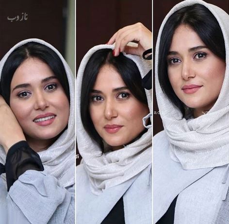 جراحی های پریناز ایزدیار و اقدام خبر ساز وی+ تصاویر
