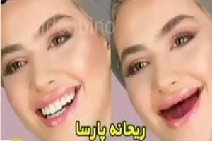 خانم بازیگران بی دندون! مجموعه عکس های طنز و خنده دار
