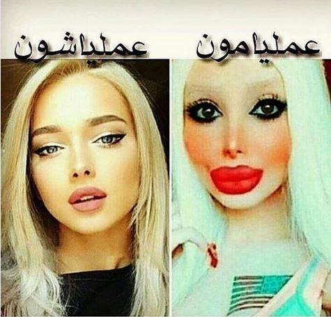 خانم بازیگران بی دندون! مجموعه عکس های طنز و خنده دار