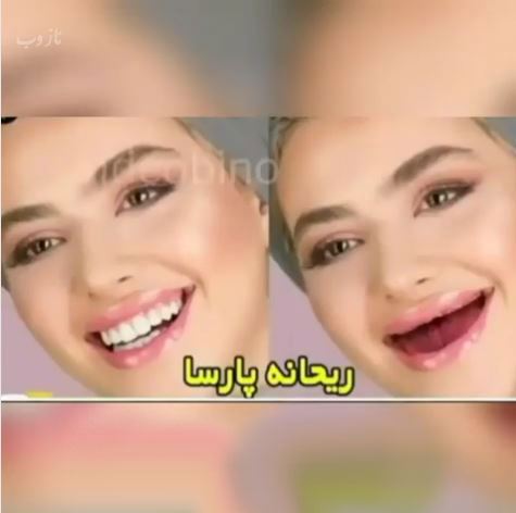 خانم بازیگران بی دندون! مجموعه عکس های طنز و خنده دار