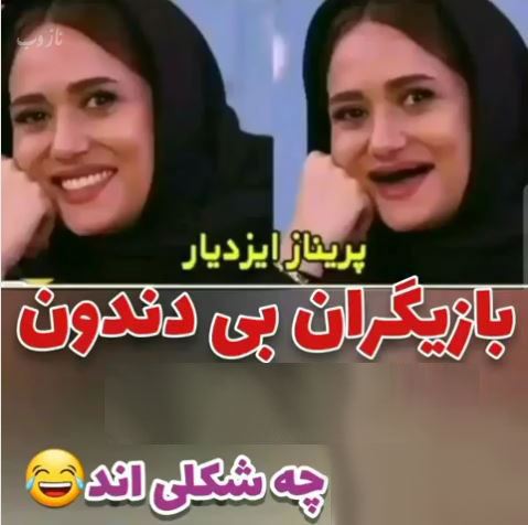 خانم بازیگران بی دندون! مجموعه عکس های طنز و خنده دار