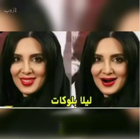 خانم بازیگران بی دندون! مجموعه عکس های طنز و خنده دار
