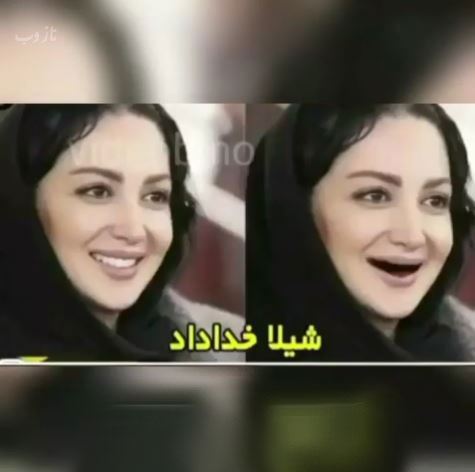 خانم بازیگران بی دندون! مجموعه عکس های طنز و خنده دار