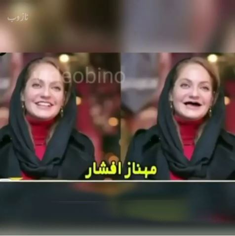 خانم بازیگران بی دندون! مجموعه عکس های طنز و خنده دار