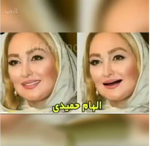 خانم بازیگران بی دندون! مجموعه عکس های طنز و خنده دار