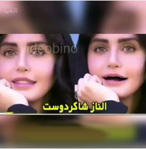 خانم بازیگران بی دندون! مجموعه عکس های طنز و خنده دار