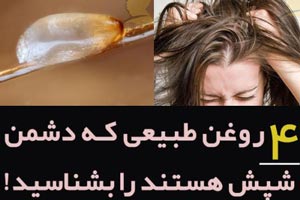 شپش چیست/ درمانهای دارویی و خانگی شپش +علائم آن