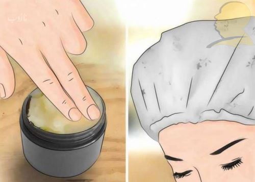 شپش چیست/ درمانهای دارویی و خانگی شپش +علائم آن