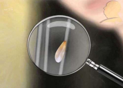 شپش چیست/ درمانهای دارویی و خانگی شپش +علائم آن