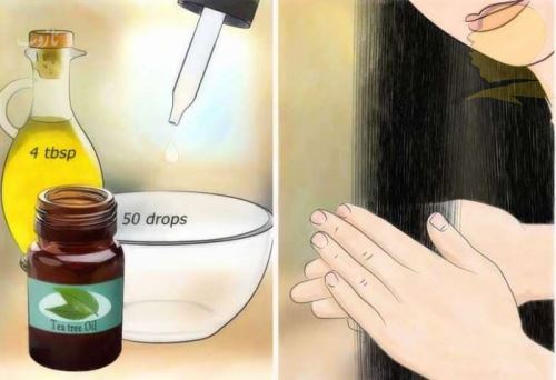 شپش چیست/ درمانهای دارویی و خانگی شپش +علائم آن