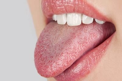 خشکی زبان و دهان چه علتی دارد+ درمان سنتی