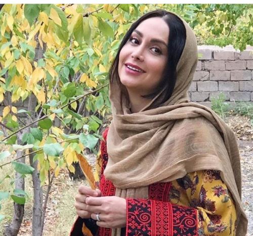 بیوگرافی جدید مریم خدارحمی و همسرش/ از ضربه مغزی تا جراحی زیبایی