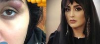 حمله وحشیانه به مریم معصومی و علت آن+ عکس