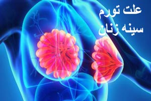 علت تورم سینه خانم ها علت تورم سینه خانم ها