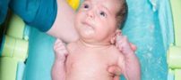 بیماری های شایع نوزادان بعد از تولد
