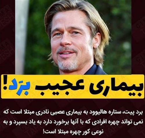 عجیب ترین دختر دنیا و تنها زن زیبای جهش یافته جهان+ تصاویر