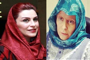 عکس دردناک از بیماری ماه چهره خلیلی عکس دردناک از بیماری ماه چهره خلیلی
