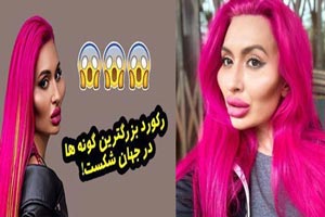 زنی که لقب زشت ترین فاحشه دنیا را گرفت/ بزرگترین گونه ها زنی که لقب زشت ترین فاحشه دنیا را گرفت/ بزرگترین گونه ها