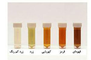 دلایل شایع و پر خطر تغییر رنگ ادرار در سلامتی