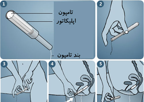 زنان و رابطه با تامپون+ آموزش تصویری تامپون