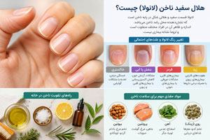 هلال سفید ناخن نشانه چیست؟ علت، علائم و راه درمان