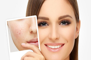 فیشیال و ماسک های درخشان کننده پوست فیشیال و ماسک های درخشان کننده پوست