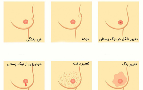 سرطان های شایع در خانمها / از رابطه دهانی تا مقعدی!